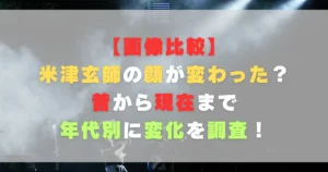 【画像比較】米津玄師の顔が変わった?昔から現在まで年代別に変化を調査!